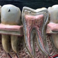 German Dental Display of Jaw Bone and Teeth Plaster New York Biologiocal Supply 18.jpg