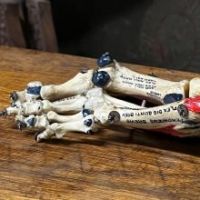 Medical Specimen Human Foot witih Hand Painted Labels 13.jpg