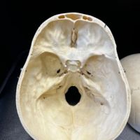 Medical Specimen Skull 11.jpg