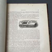 Circulator N0. 6 S.G.O. Reports of the Materials for a Medical and Surgical History of the Rebellion 25.jpg