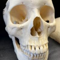 Medical Specimen Skull 12.jpg