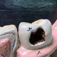 German Dental Display of Jaw Bone and Teeth Plaster New York Biologiocal Supply 17.jpg