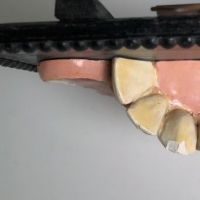 German Dental Display of Jaw Bone and Teeth Plaster New York Biologiocal Supply 19.jpg
