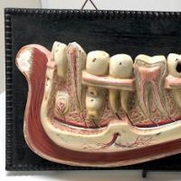 German Dental Display of Jaw Bone and Teeth Plaster New York Biologiocal Supply 6.jpg