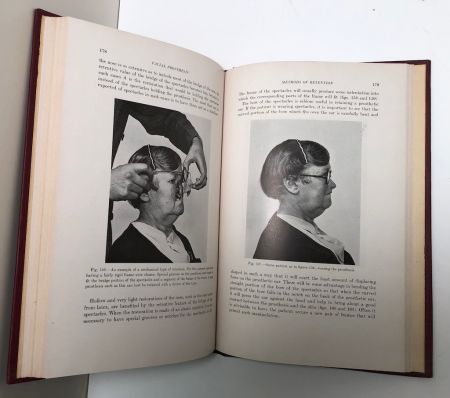 Facial Prosthesis By Arthur Bulbulian 1st Edition Hardback 1945 W. B. Saunders 7.jpg