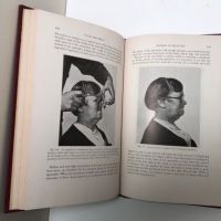 Facial Prosthesis By Arthur Bulbulian 1st Edition Hardback 1945 W. B. Saunders 7.jpg