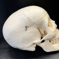 Medical Specimen Skull 4.jpg