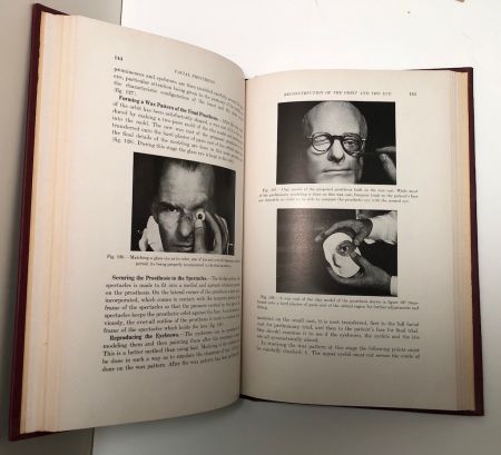 Facial Prosthesis By Arthur Bulbulian 1st Edition Hardback 1945 W. B. Saunders 8.jpg