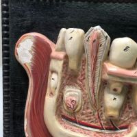 German Dental Display of Jaw Bone and Teeth Plaster New York Biologiocal Supply 8.jpg