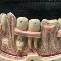 German Dental Display of Jaw Bone and Teeth Plaster New York Biologiocal Supply 9.jpg