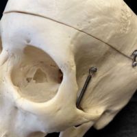 Medical Specimen Skull 6.jpg