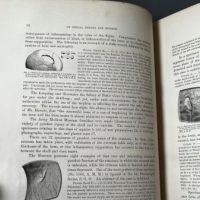 Circulator N0. 6 S.G.O. Reports of the Materials for a Medical and Surgical History of the Rebellion 20.jpg