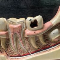 German Dental Display of Jaw Bone and Teeth Plaster New York Biologiocal Supply 10.jpg