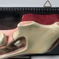 German Dental Display of Jaw Bone and Teeth Plaster New York Biologiocal Supply 12.jpg