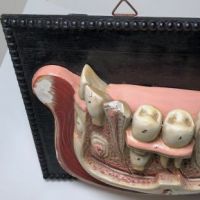 German Dental Display of Jaw Bone and Teeth Plaster New York Biologiocal Supply 13.jpg