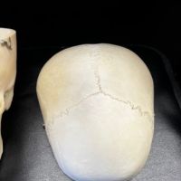Medical Specimen Skull 10.jpg